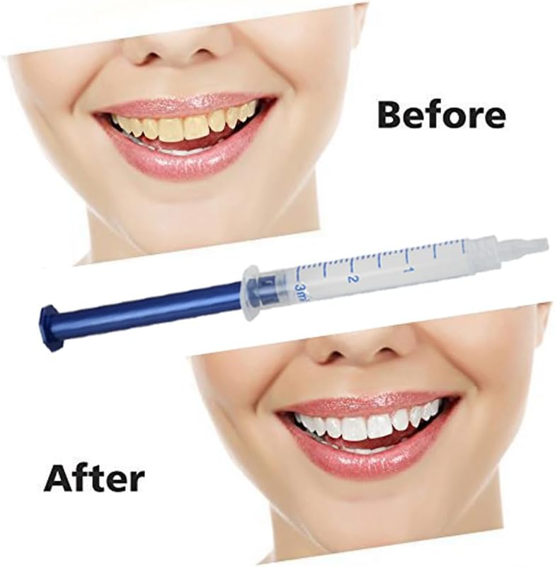 Peroxide Dental Teeth Whitening Kit